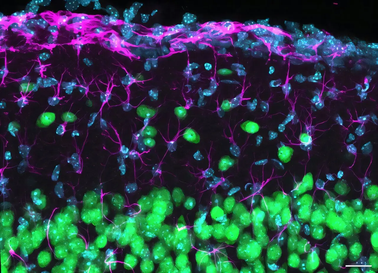 Scientists discover how distant brain synapses stay ready for change
