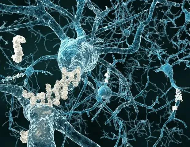Scientists Restore Memory-Linked Neuron Function in Alzheimer's Mice